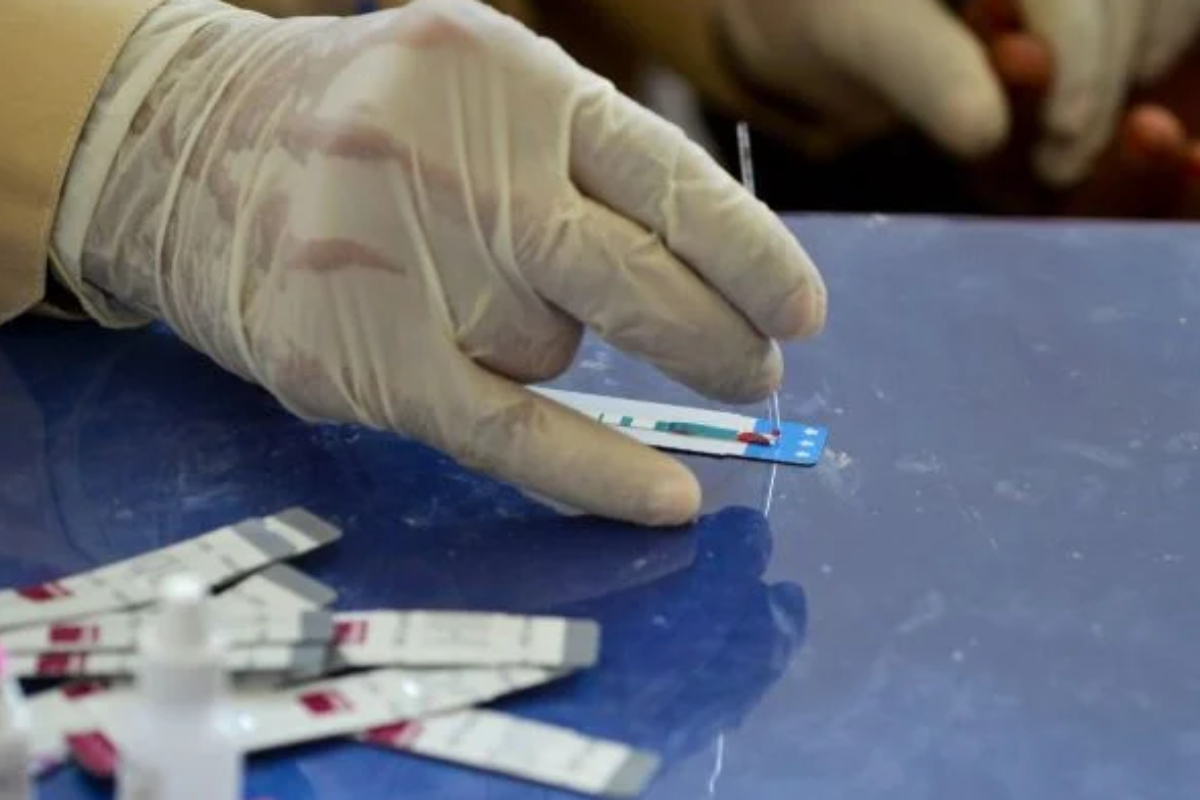 HIV cases surge