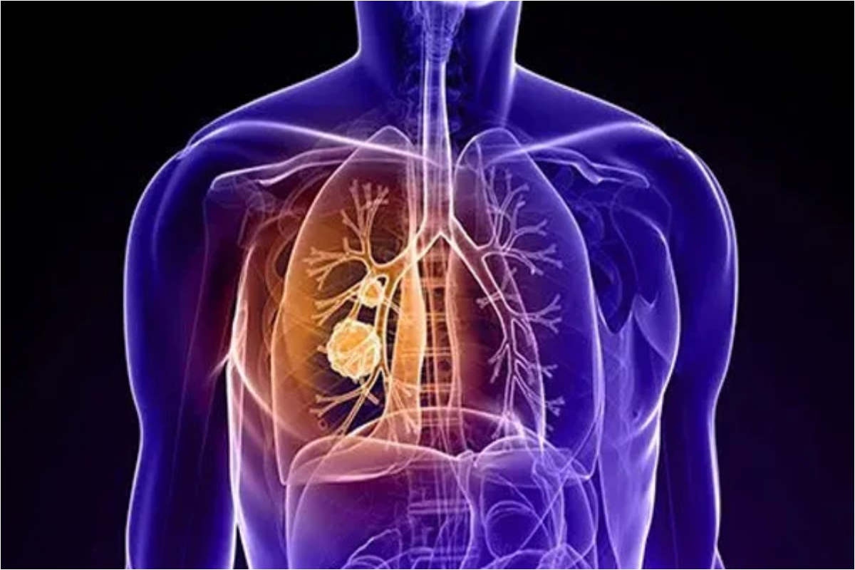 China’s lung